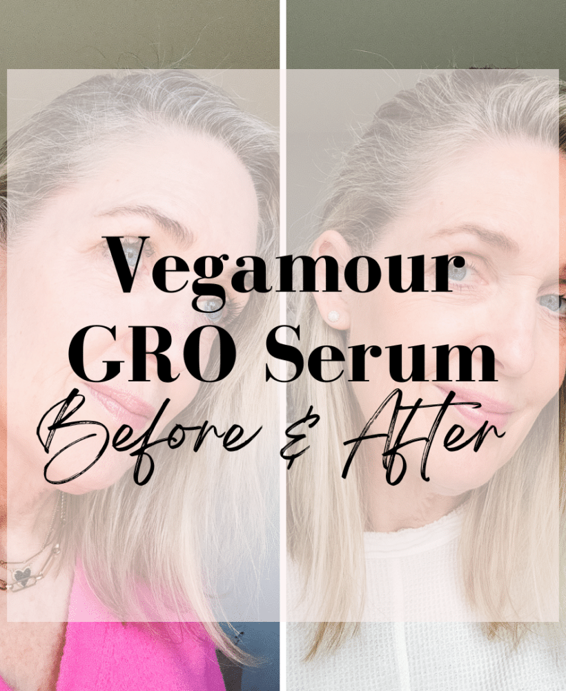 I Tried Vegamour for 3 Months: My Before & After